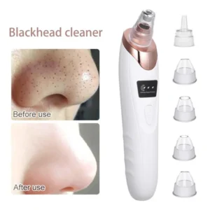 Electric Blackhead Remover – Deep Pore Cleansing Facial Device